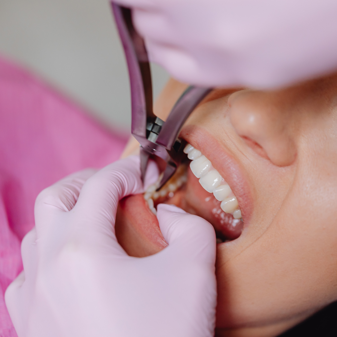 Oral Surgery Andheri East